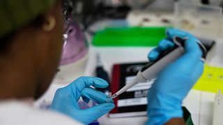 Trump Administration's funding cuts jeopardize HIV research in South Africa