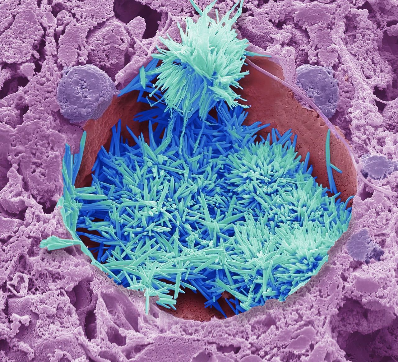 Cholesterol in the Liver 2022 by Steve Gschmeissner