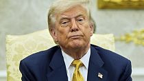 White House confirms Trump diagnosed with common vascular condition