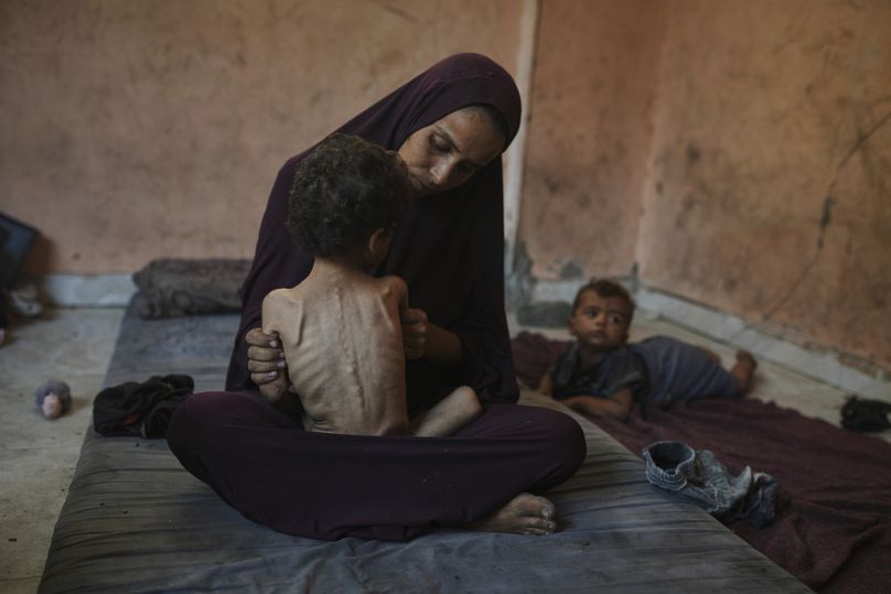أم تحمل طفلها يزن الذي يعاني من سوء تغذية، في منزلهما بمخيم الشاطئ للاجئين في مدينة غزة، الأربعاء 23 يوليو 2025.