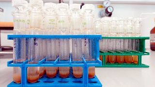 Sealed urine specimens stand in a laboratory at the institute for doping analysis and sports biochemistry in Kreischa, eastern Germany, in this Aug. 23, 2006.