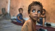کودک ۲ ساله مبتلا به سوءتغذیه، روز چهارشنبه، ۲۳ ژوئیه ۲۰۲۵، در خانه خانوادگی خود در اردوگاه پناهندگان شطی در شهر غزه 