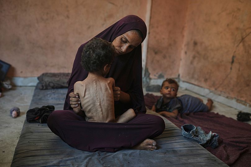 Naima Abu Ful posa para uma fotografia com o seu filho desnutrido de 2 anos, Yazan, na sua casa no campo de refugiados de Shati, na Cidade de Gaza, quarta-feira, 23 de julho