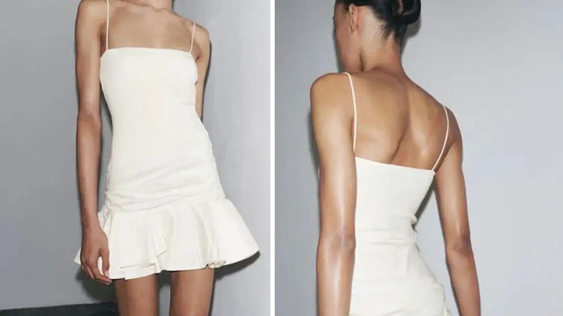 “Protruding collarbone” and "gaunt" appearance