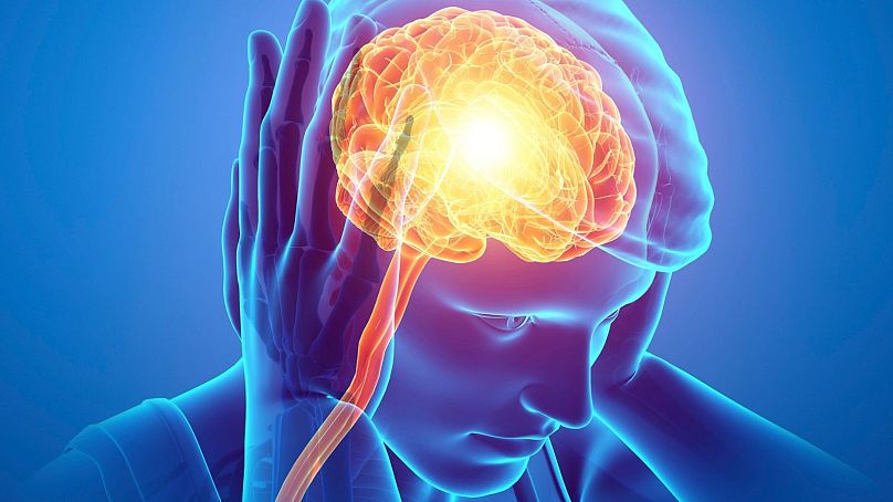Migrane and a right-leaning brain activity