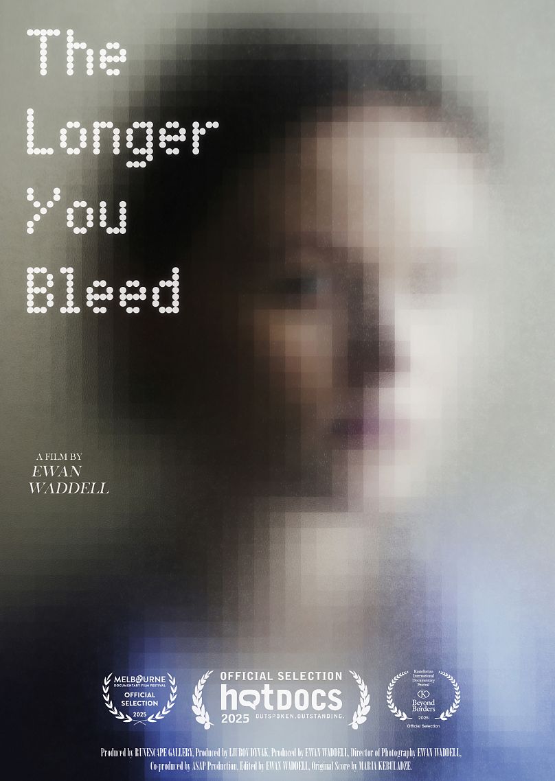 «The longer you bleed»