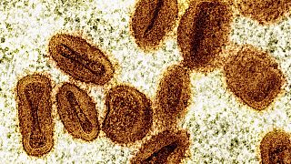 Épidémie de MPOX : l'OMS lève l'urgence sanitaire en Afrique
