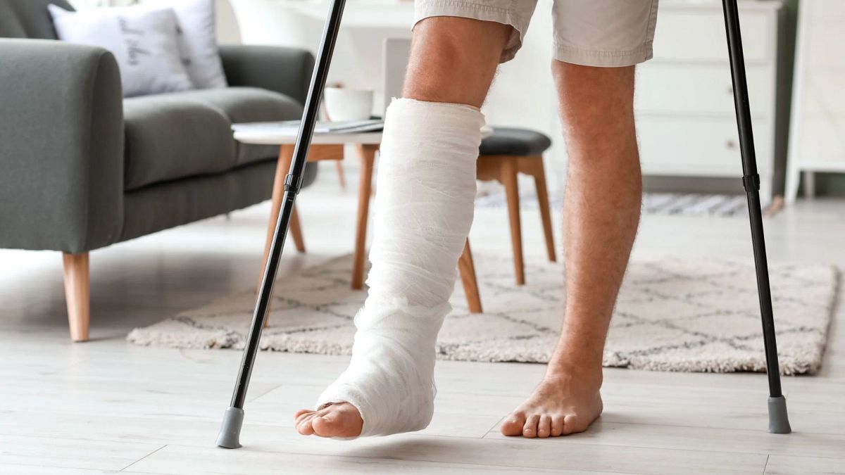 Cosmetic leg-lengthening surgery: UK doctor sounds alarm over 'extremely painful' procedure