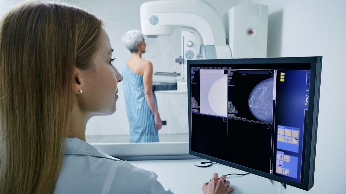 Grâce à l'IA, une mammographie suffit pour prédire les risques cardiaques des femmes