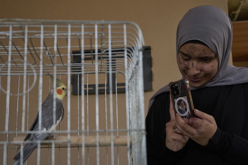 سارة جعفال (21 عامًا)، المصابة في هجوم أجهزة النداء في 17 سبتمبر 2024، في منزلها ببلدة بازورية جنوب لبنان، 1 مايو 2025.