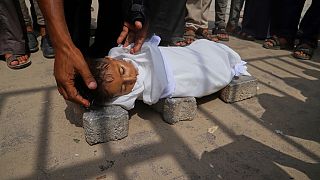 Gaza : les ravages de la malnutrition