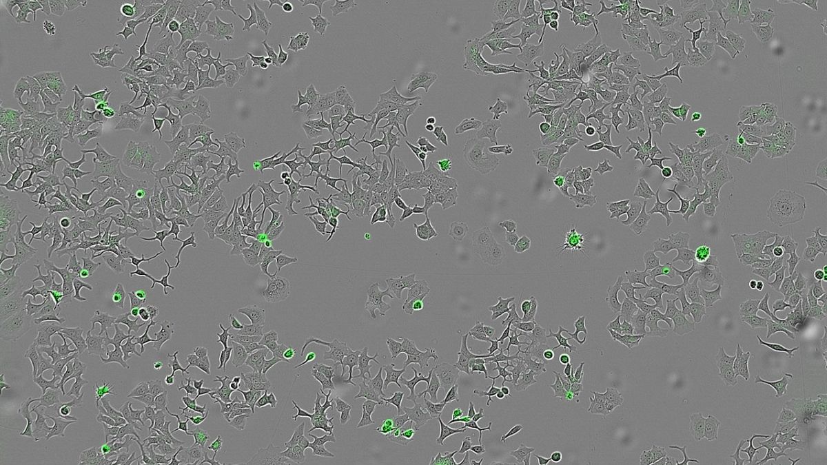 Special protein found in bacteria could cause cancer cells to self-destruct, Spanish scientists say