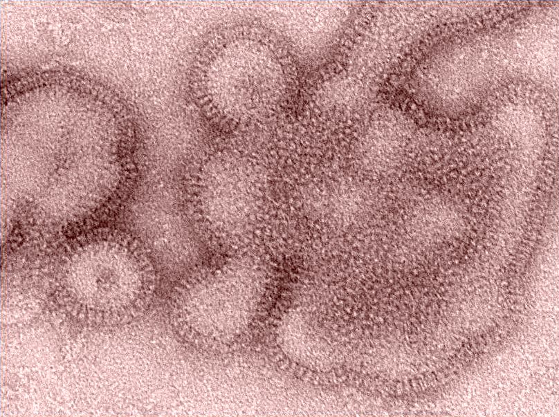 Az influenzavírus H3N2 variánsa elektronmikroszkóp alatt