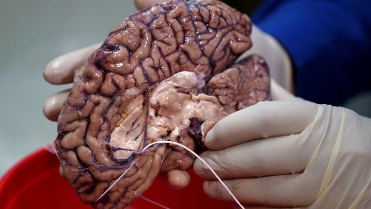 Scientists hunt down genes behind humankind's big brain