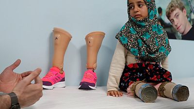 طفلة سورية ولدت بدون ساقين تخطو خطواتها الأولى في اسطنبول
