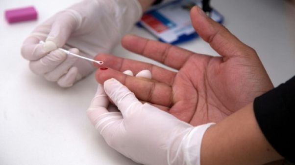 Une personne fait le test du Sida, le 23 juin 2018 à Santiago du Chili Une personne fait le test du Sida, le 23 juin 2018 à Santiago du Chili