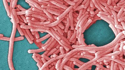 Legionella: sono 40 persone contagiate Legionella: sono 40 persone contagiate