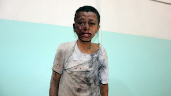 Yémen: au moins 29 enfants tués dans une attaque, l'ONU veut une enquête "indépendante" Yémen: au moins 29 enfants tués dans une attaque, l'ONU veut une enquête "indépendante"