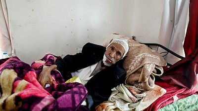 مرضى السرطان.. ضحايا آخرون للحرب في اليمن