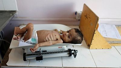 Yemen war a 'living hell' for children - UNICEF Yemen war a 'living hell' for children - UNICEF