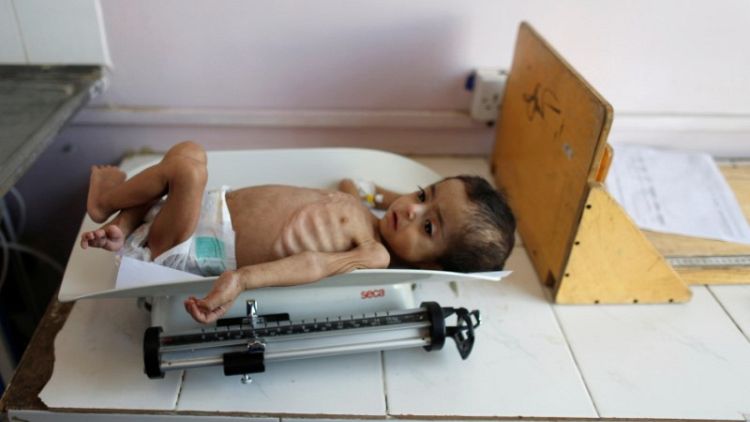 Yemen war a 'living hell' for children - UNICEF