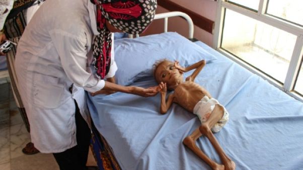 Guerre au Yémen: plus de cinq millions d'enfants menacés de famine Guerre au Yémen: plus de cinq millions d'enfants menacés de famine