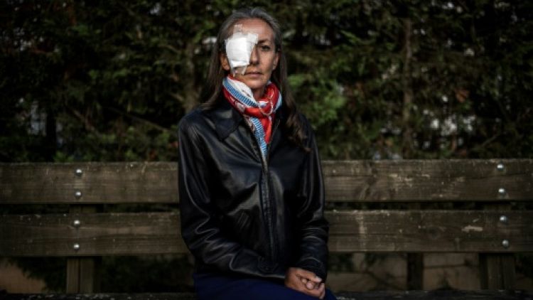 Spectatrice blessée à la Ryder Cup: "une plainte pour alerter sur la sécurité du public"