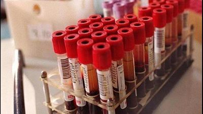 Figlia indagata, fa cambiare provetta Figlia indagata, fa cambiare provetta