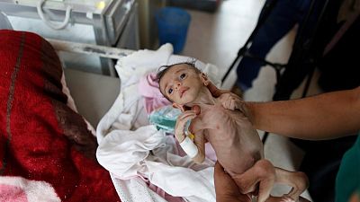 يونيسف: أطفال اليمن يموتون وأطراف الصراع تمنع وصول المساعدات يونيسف: أطفال اليمن يموتون وأطراف الصراع تمنع وصول المساعدات