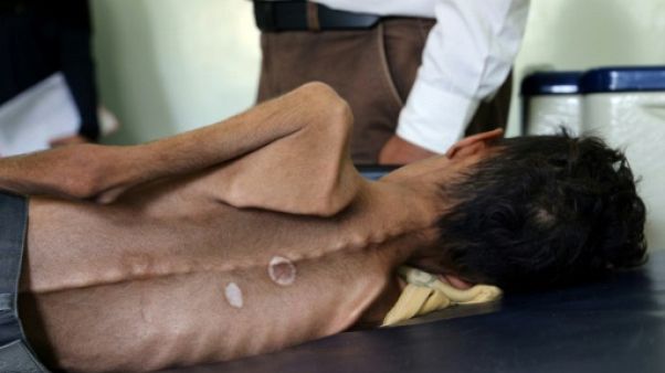 Le Yémen en guerre, un "enfer sur terre" pour les enfants (Unicef) Le Yémen en guerre, un "enfer sur terre" pour les enfants (Unicef)