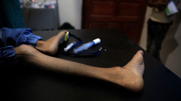 Calls for end to Yemen war offer little hope for hungry children Calls for end to Yemen war offer little hope for hungry children