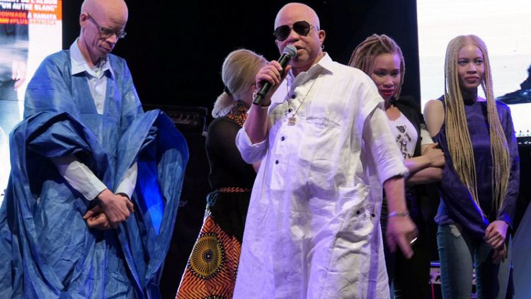Mali singer Salif Keita highlights plight of African albinos