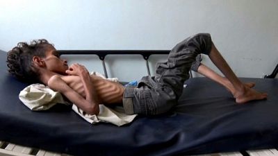 85.000 enfants morts de faim ou de maladie au Yémen, selon Save the Children