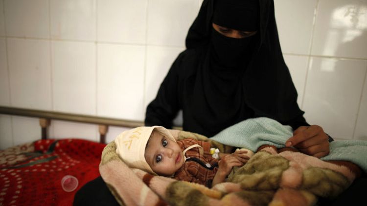 More than 80,000 Yemeni children may have died from hunger - humanitarian body