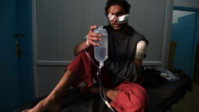Un homme blessé dans l'attentat du 20 novembre 2018 à Kaboul.