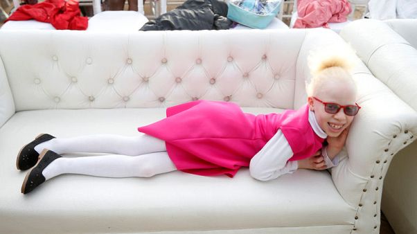 Kenyan charity holds pageant to affirm dignity of people with albinism Kenyan charity holds pageant to affirm dignity of people with albinism
