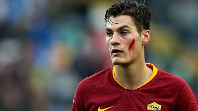 Roma, Schick si affida a mental coach Roma, Schick si affida a mental coach