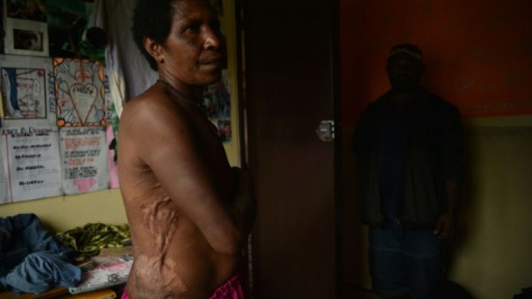 La chasse aux sorcières fait régner la terreur sur les Hautes-Terres de Papouasie