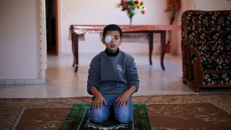 A picture and its story: A boy injured in clashes in Gaza