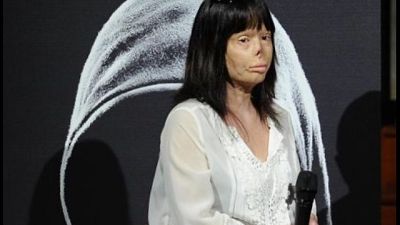 Sfigurata da marito: dubbi su morte ex Sfigurata da marito: dubbi su morte ex