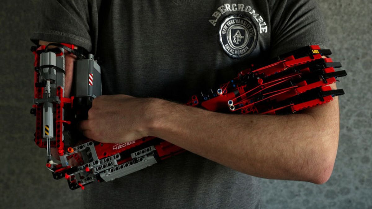 Brick by Lego brick, teen builds his own prosthetic arm