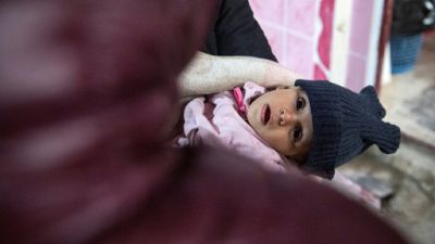 La malnutrition, nouvelle épreuve des bébés ayant fui l'EI dans l'est syrien
