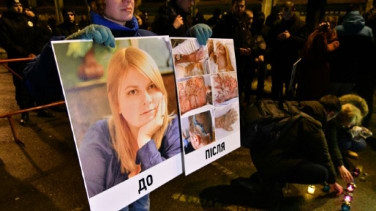Ukraine: un élu poursuivi pour l'attaque à l'acide d'une militante 