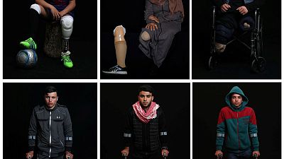 Artificial limbs change lives for wounded Gaza protesters Artificial limbs change lives for wounded Gaza protesters