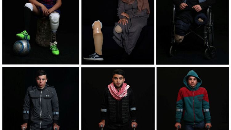 Artificial limbs change lives for wounded Gaza protesters