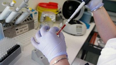 Meningite: 21enne muore nell'Aretino Meningite: 21enne muore nell'Aretino