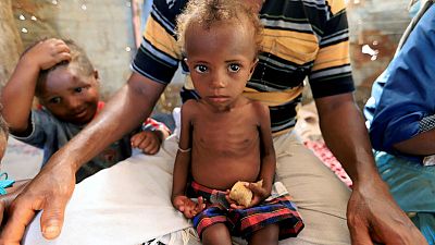 With focus on Hodeidah, Yemen's war rages on elsewhere With focus on Hodeidah, Yemen's war rages on elsewhere