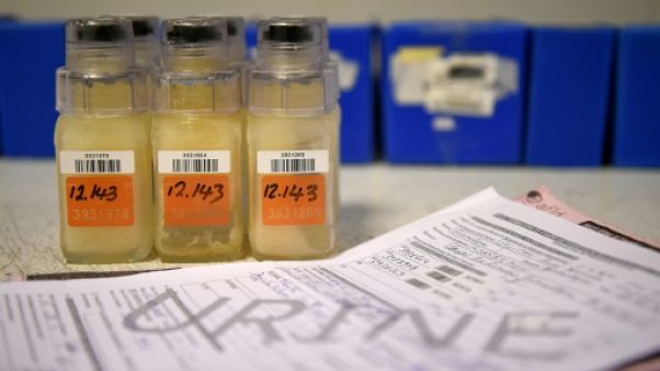 Un échantillon d'urine avant une analyse au laboratoire de l'Agence française de lutte antidopage, le 15 décembre 2015 à Chatenay-Malabry Un échantillon d'urine avant une analyse au laboratoire de l'Agence française de lutte antidopage, le 15 décembre 2015 à Chatenay-Malabry