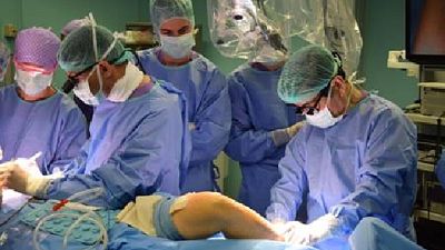 Da osso perone ricostruita mandibola Da osso perone ricostruita mandibola
