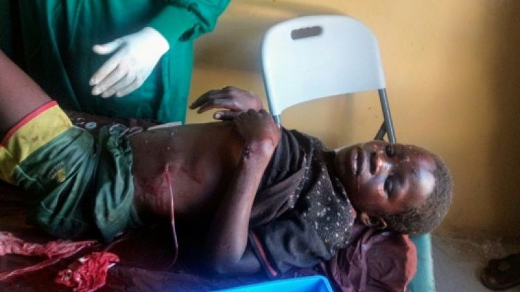 Une victime reçoit des soins après un triple attentat-suicide à Konduga, à 38 km de Maiduguri, au Nigeria, le 17 juin 2019
